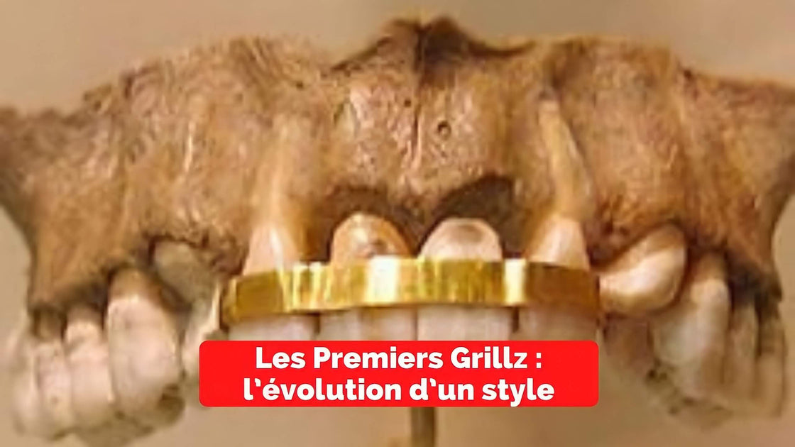 Les grillz – des bijoux dentaires venus de la culture hip-hop