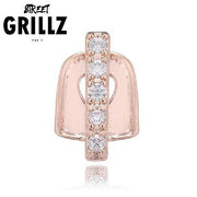 Grillz dents du bonheur bronze rose